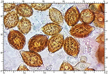 Hymenogaster mischosporus